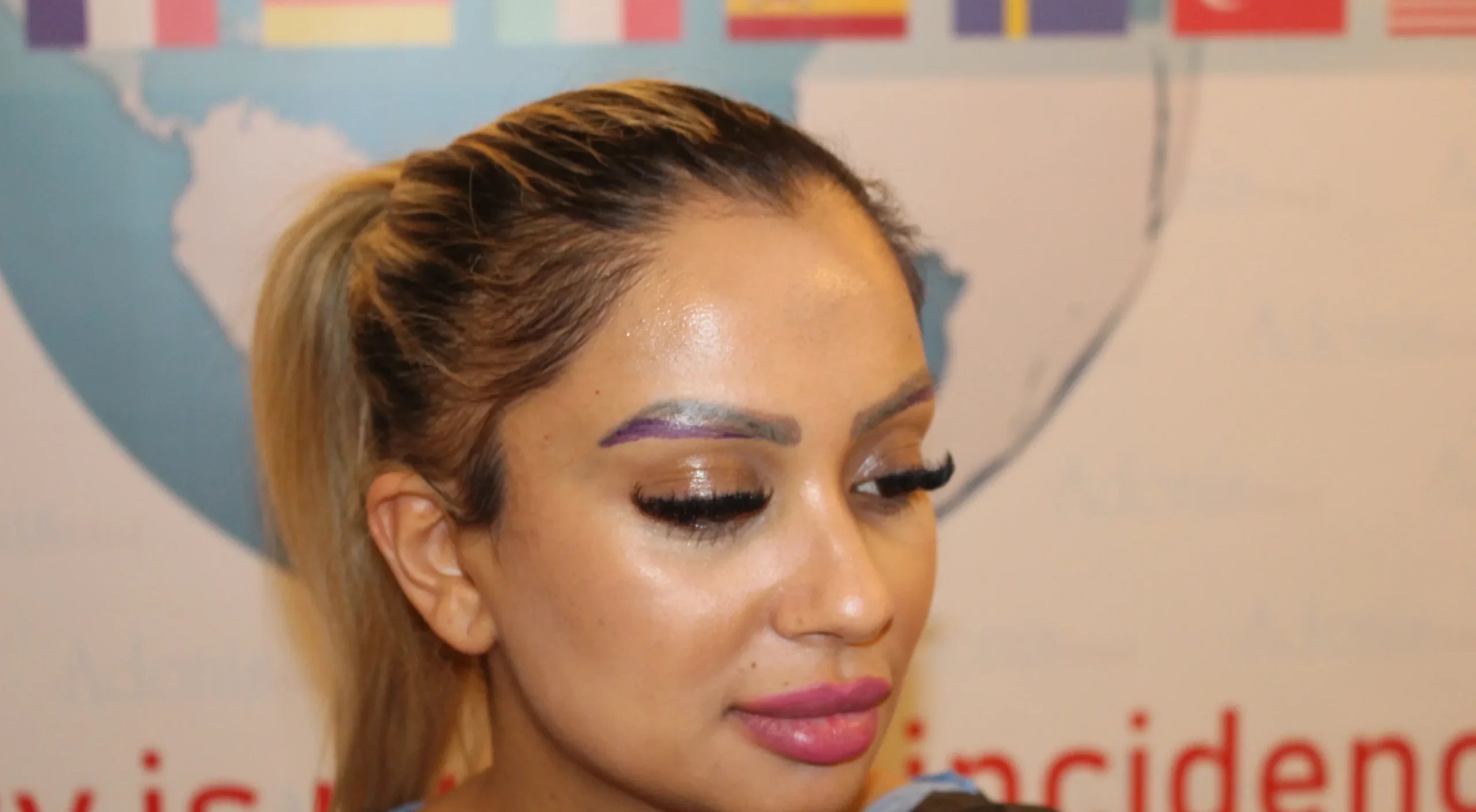 Natural Eyebrow Transplant for a Transformed Expression: The Ultimate Way to Move Beyond Permanent Makeup