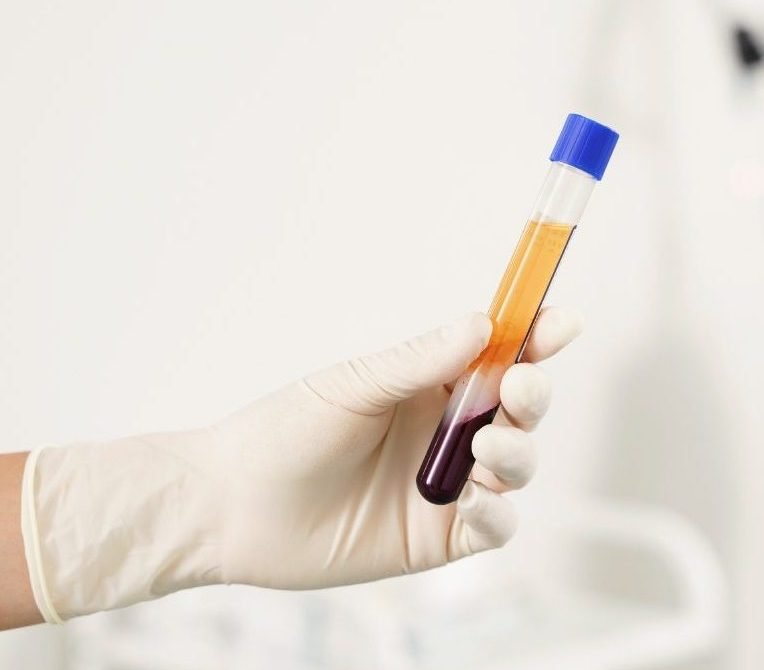 Why is PRP used?