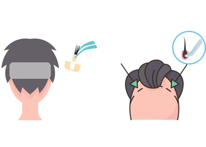 Remove background project